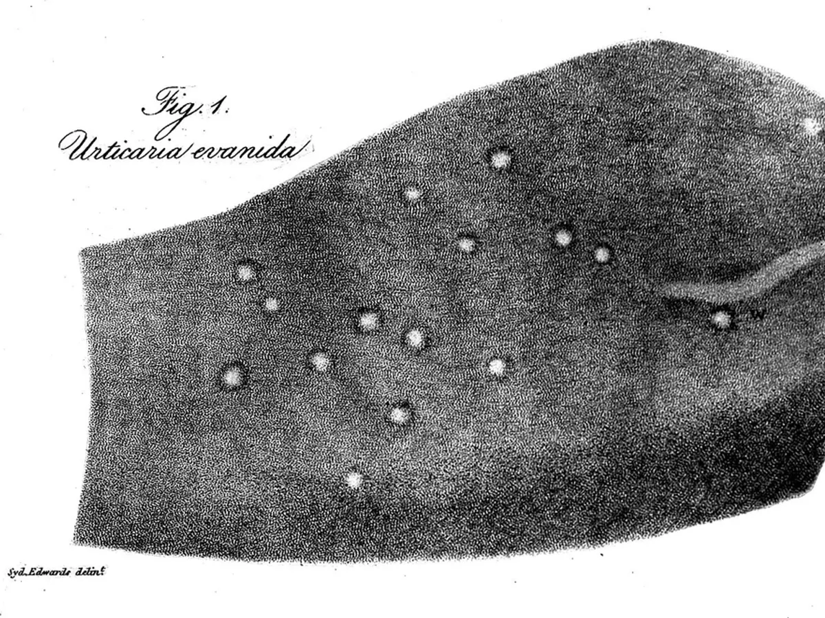 cutaneous diseases ... / Robert